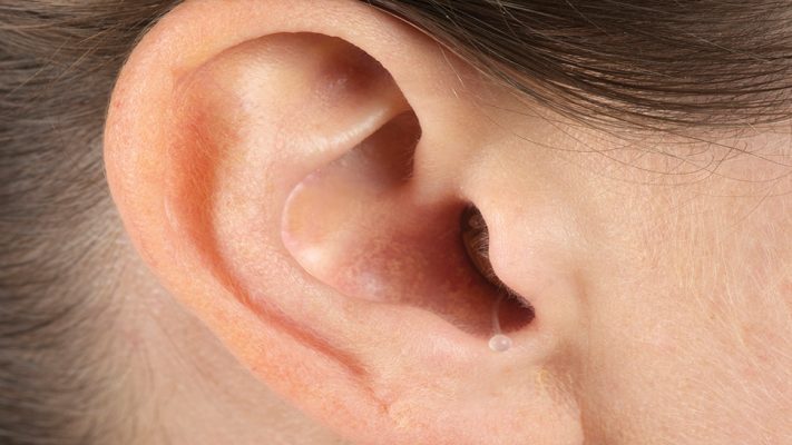 invisible hearing aids for high frequency loss